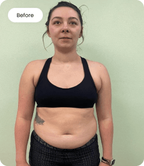 weightLoss1Before