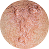 the image